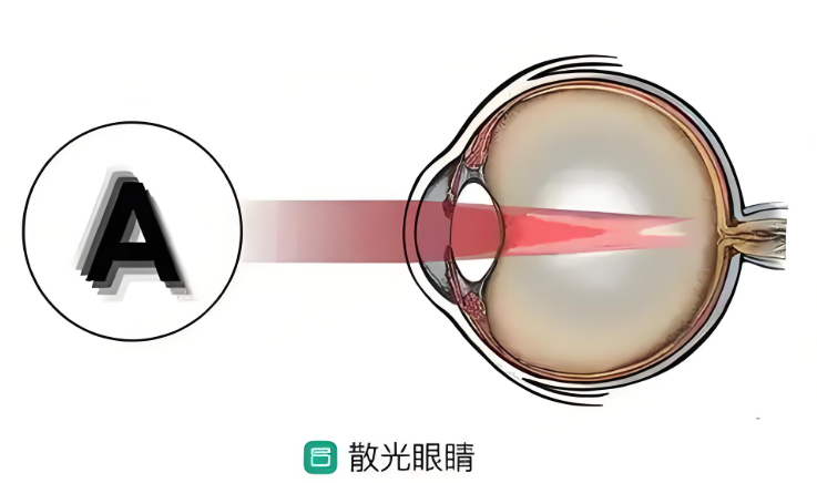 唐山眼科医院儿童散光挂什么科——小儿眼科 唐山眼科医院儿童散光挂什么科——小儿眼科