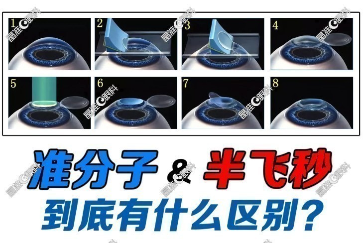 准分子和飞秒的优缺点www.ji-zhun.com
