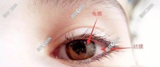 怎么分辨角膜炎和结膜炎ji-zhun.com
