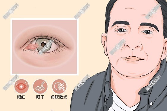 翼状胬肉手术大概多少钱