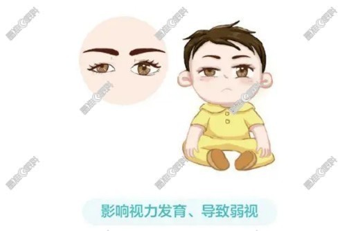 儿童上眼睑下垂手术费用多少钱