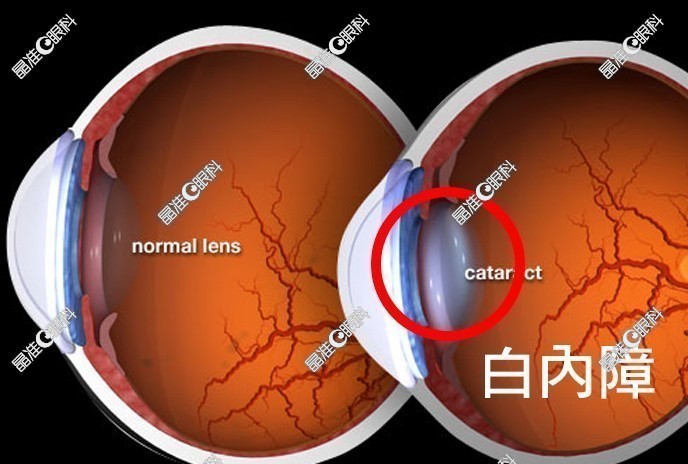 何氏眼科何伟有多牛