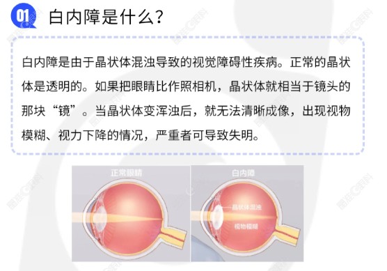 什么人不适合做三焦人工晶体