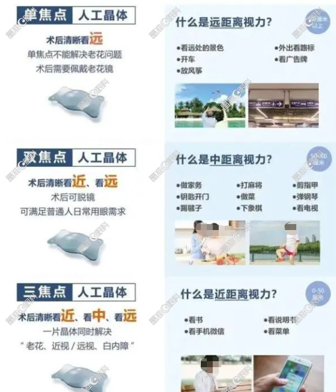 眼外伤晶体摘除后植入哪种人工晶体好