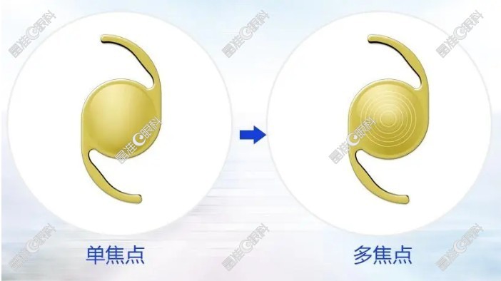 单焦点人工晶体和多焦点人工晶体的区别
