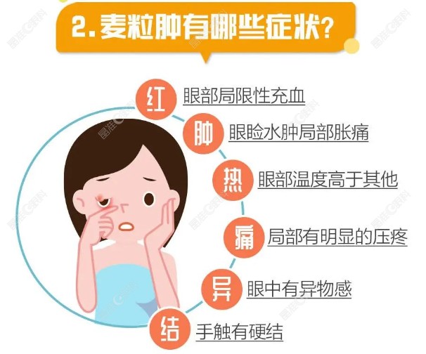 麦粒肿图片和症状分享
