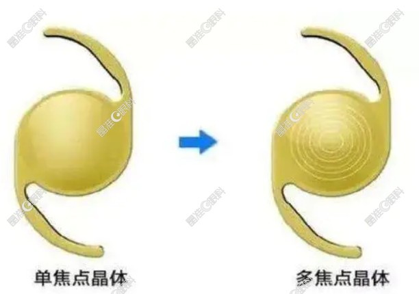 单焦点晶体和多焦点晶体区别