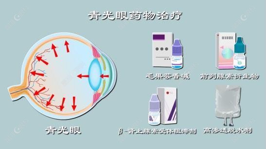 青光眼的治疗方法ji-zhun.com