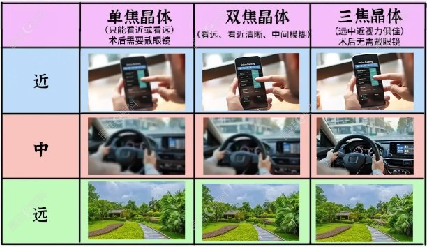 白内障多焦点晶体价格2023www.ji-zh/un.com