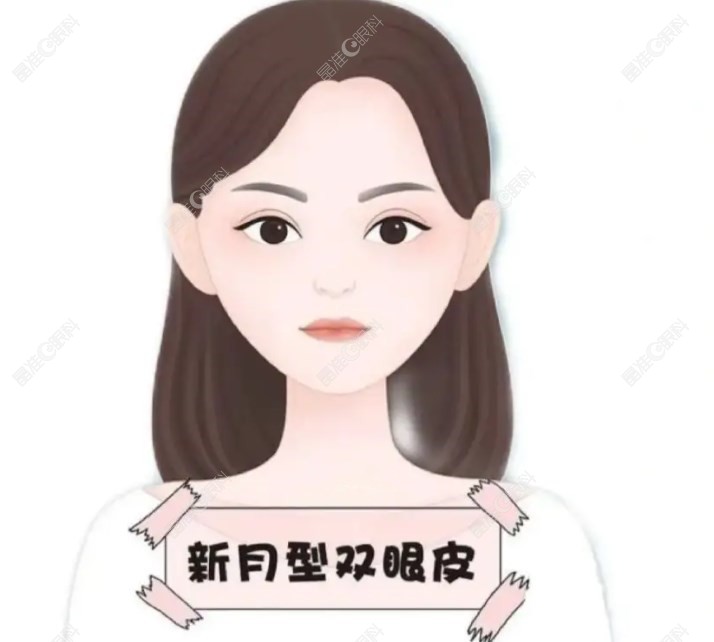 新月型双眼皮图片www.ji-zhu#n.com