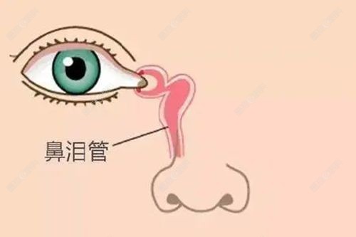 成人泪道探通手术怎么做