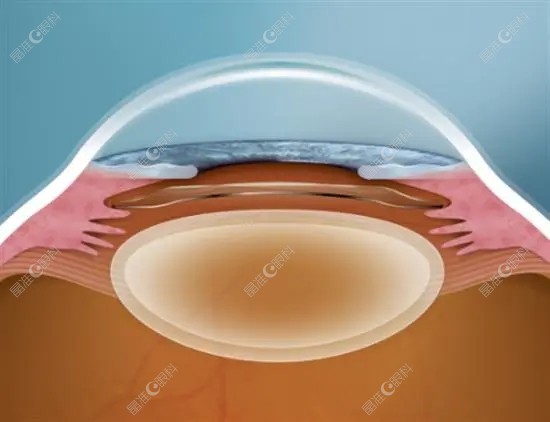 眼力健晶体性价比稍高疗效也不错www.ji-zhun.com