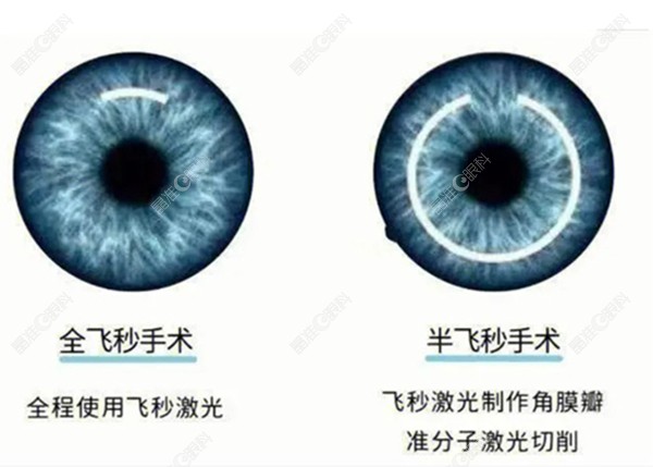 全飞秒和半飞秒对比