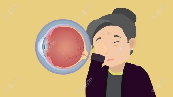 老年人做白内障选择什么样的晶体好