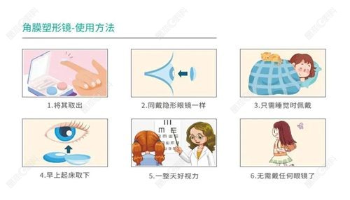 北京铂林眼科石璟眼科诊所开展项目