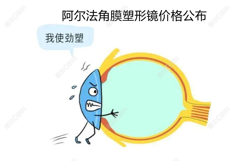 日本阿尔法角膜塑形镜