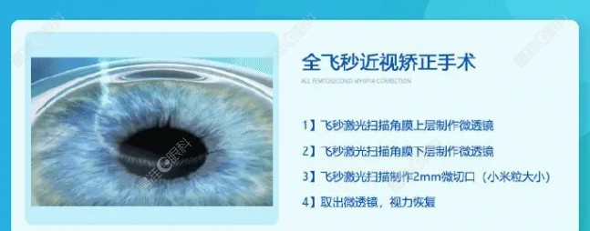 全飞秒近视手术原理