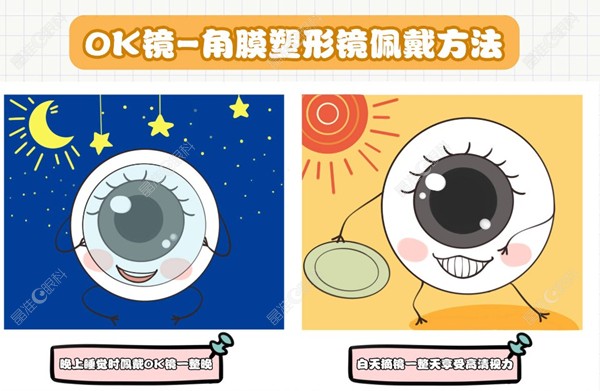 角膜塑形镜的佩戴方法