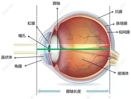 小孩眼轴长度与近视对照表ji-zhun.com
