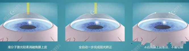 贵港爱眼眼科医院是免费的吗