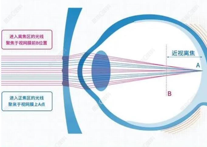 星趣控和新乐学的镜片哪个防控成效好ji-zhun.com