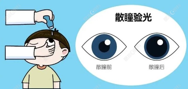 散瞳验光和不散瞳验光的区别