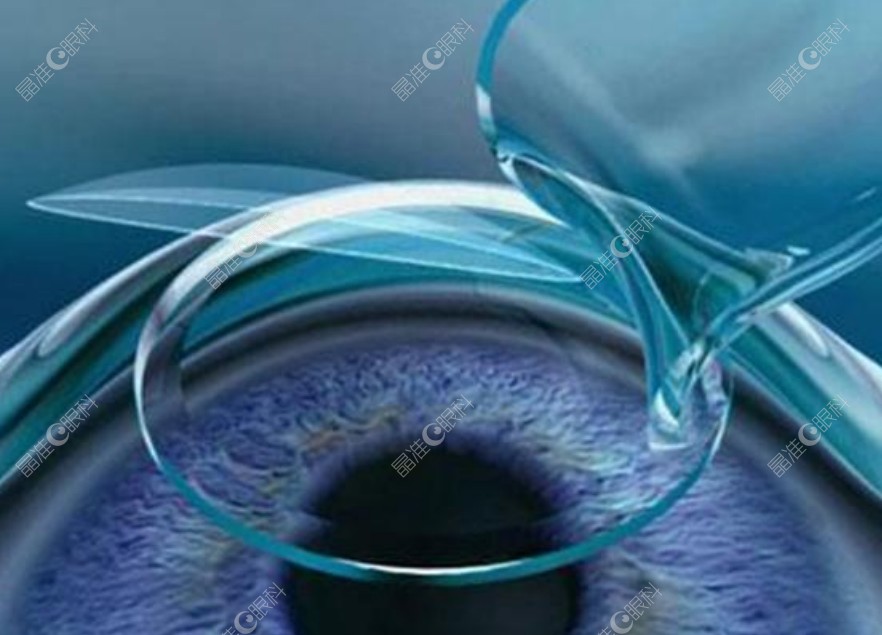 南昌爱尔眼科近视手术ji-zhun.com