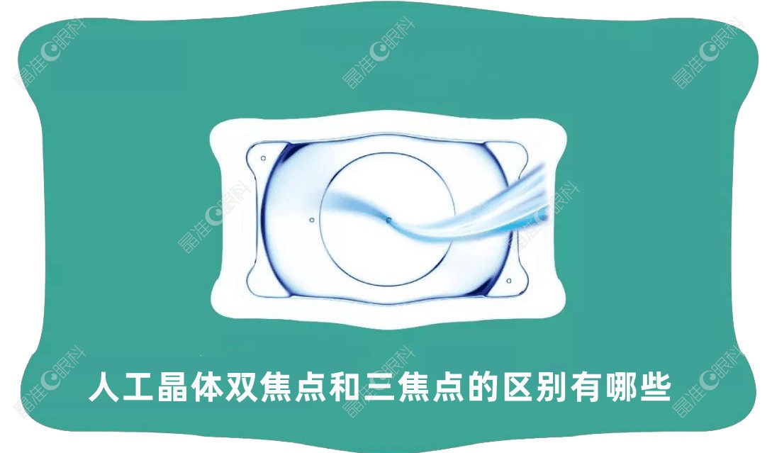 人工晶体双焦点和三焦点的区别