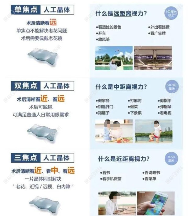 蔡司三焦点散光人工晶体939型号缺点和弊端