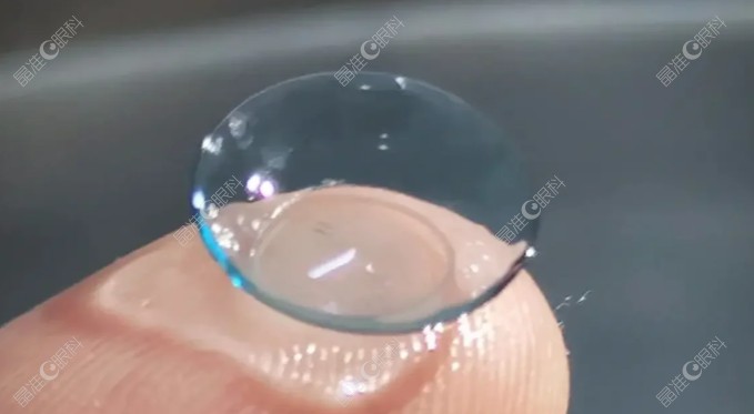 比较欧几里得和梦戴维角膜塑形镜舒适度
