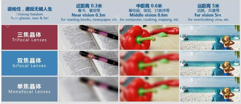 77岁老年人白内障用单焦还是多焦？20%会选择多焦点晶体ji-zhun.com