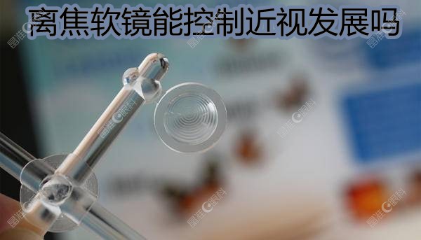 离焦软镜能控制近视发展吗