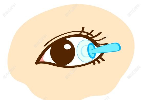 ok镜一副可以用多久更换