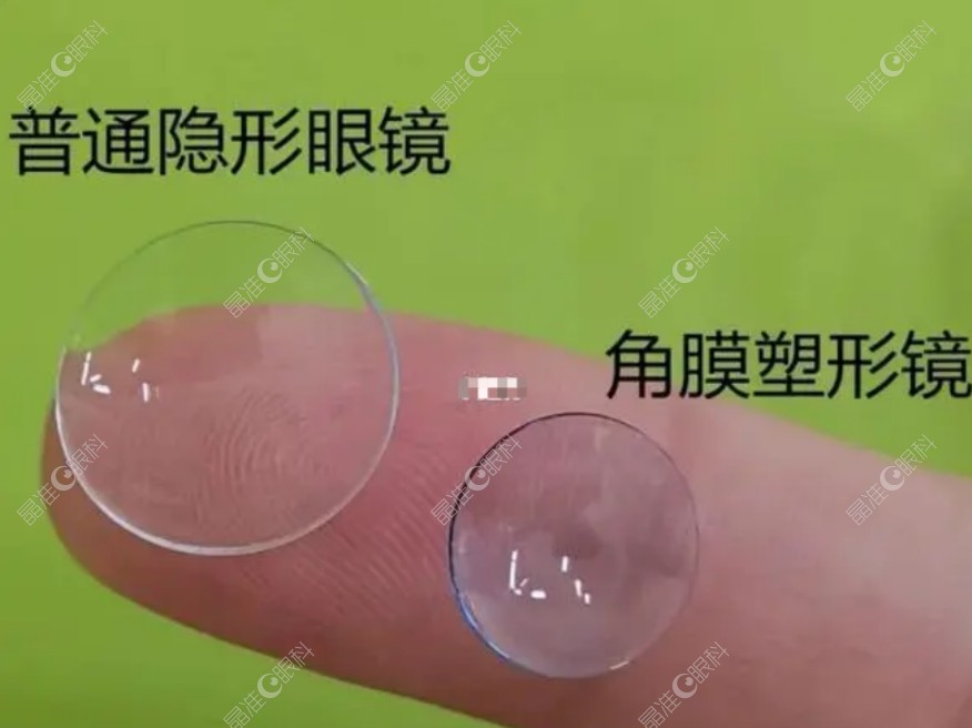 角膜塑形镜ji-zhun.com