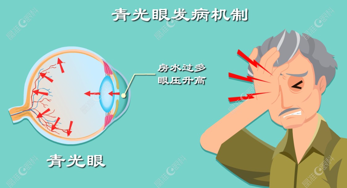 石峰医生做青光眼手术好不好