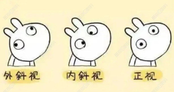 外斜视和内斜视哪个严峻