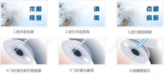 有飞蚊症能不能做近视眼手术www.ji-zhun.com