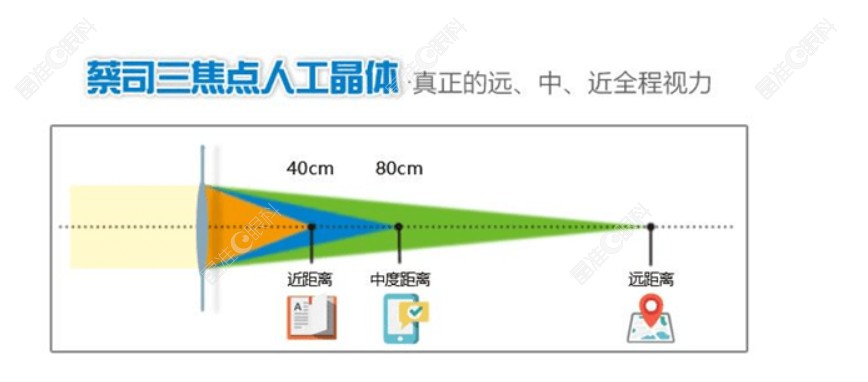 德国蔡司三焦点人工晶体视力范围