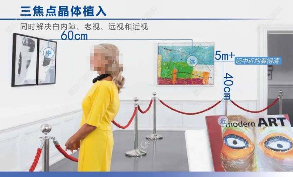 白内障三焦点人工晶体怎么样