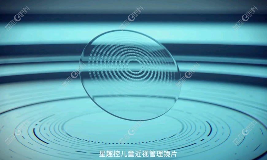 依视路星趣控镜片价格