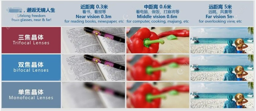 蔡司三焦人工晶体价格多少钱www.ji-zhun.com