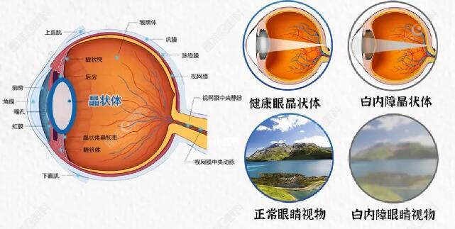 德国蔡司晶体价格2023版