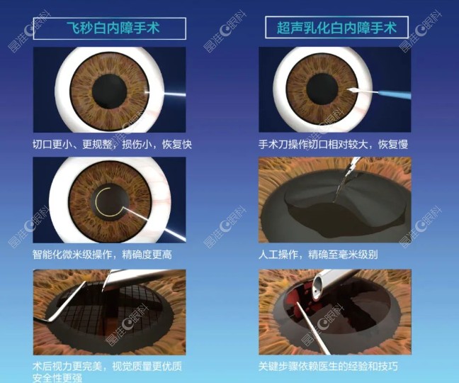 郝燕生擅长白内障手术