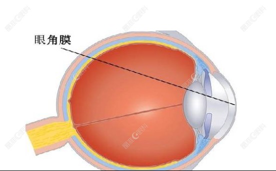 眼角膜