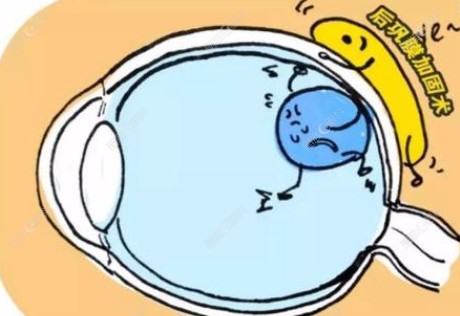 高度近视做后巩膜加固术可提高视力