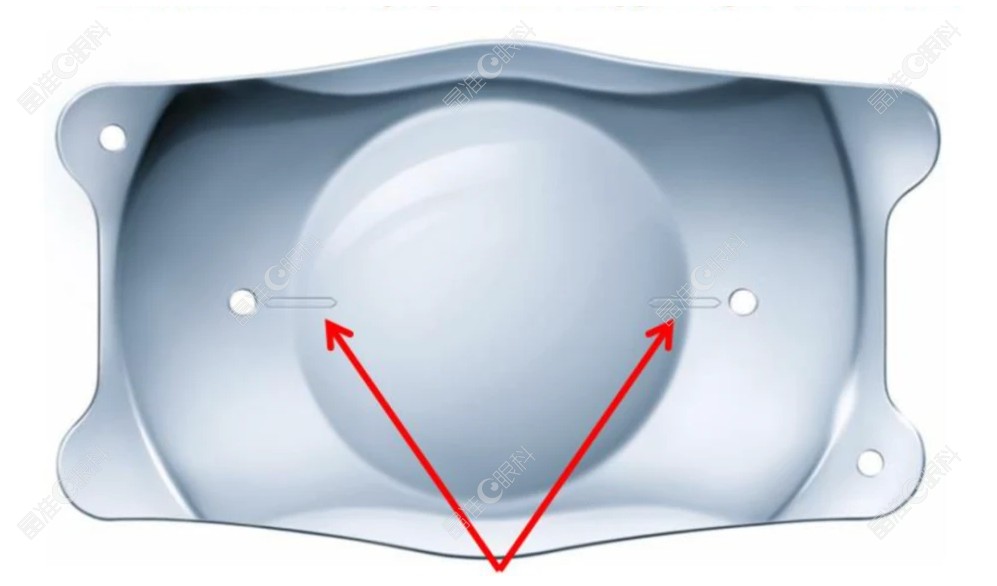 晶体植入加散光易移位增加风险www.ji-zhun.com 晶体植入加散光易移位增加风险www.ji-zhun.com