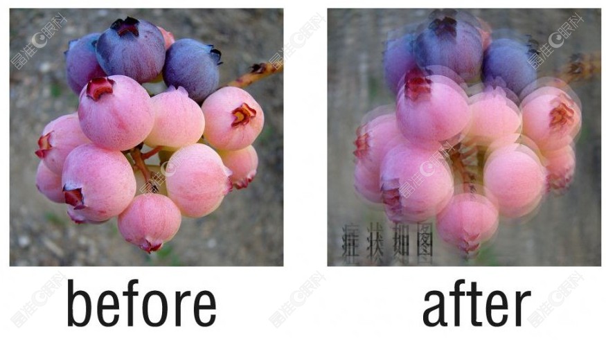 带散光晶体出现移位旋转要及时的做手术复位 带散光晶体出现移位旋转要及时的做手术复位