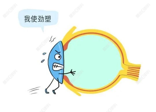普诺瞳角膜塑形镜适合什么人戴