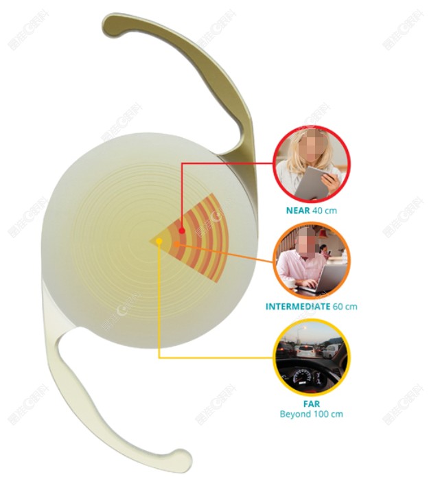 3700元的爱尔康人工晶体型号有哪些