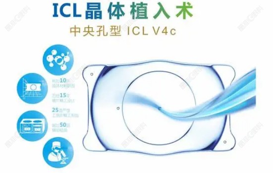 爱尔眼科做icl是v5还是v4